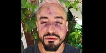 Feroz asalto homofóbico en el centro de la capital\u002E (Web)\u002E