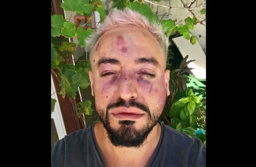 Feroz asalto homofóbico en el centro de la capital