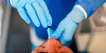 Coronavirus test\u002E
