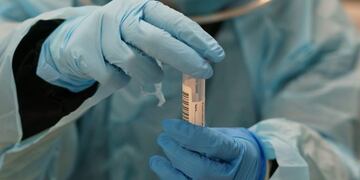 A healthcare worker dressed in protective gear collects samples from people to detect the COVID-19 disease at the La Jota health centre in Zaragoza on August 10, 2020\u002E - Spain has added 19,405 new coronavirus cases in the past week, but the health ministry says the country is not entering a second wave of the pandemic\u002E (Photo by CESAR MANSO / AFP)