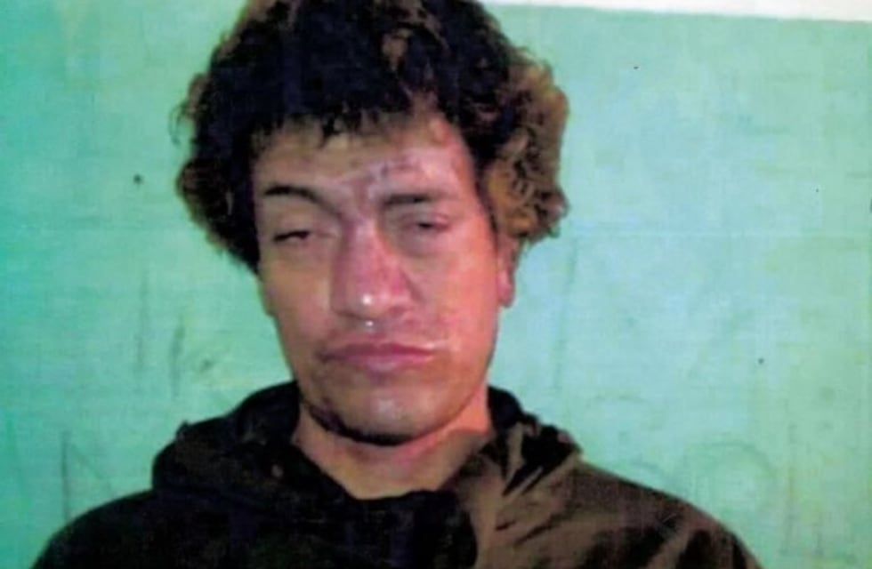 A "Pity" Álvarez le encontraron una cucaracha viva en el oído