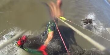 Un kitesurfer fue brutalmente atacado por un pitbull mientras practicaba su deporte en Punta Rasa\u002E