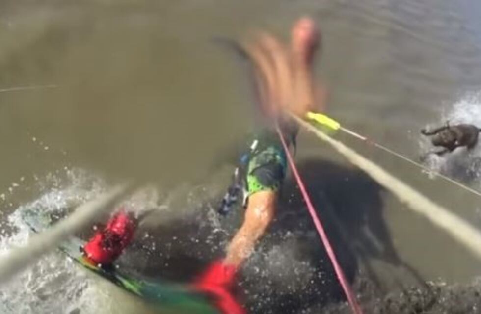 Hacía kitesurf en San Clemente del Tuyú y fue brutalmente atacado por un pitbull