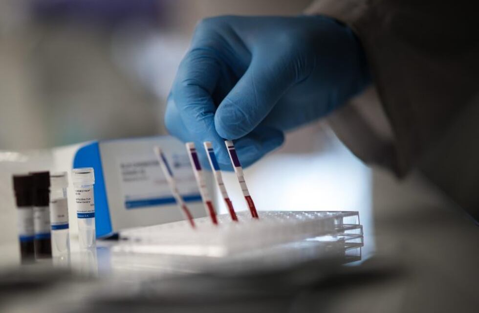 La OMS cree que a fin de año estarán disponibles "millones de dosis" de vacunas contra el covid-19