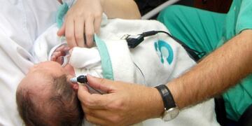 Detección temprana de la hipoacusia