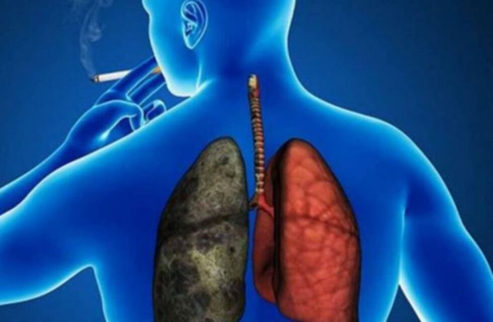 Se realizará en Córdoba la Conferencia Latinoamericana sobre el Cáncer de Pulmón 2018