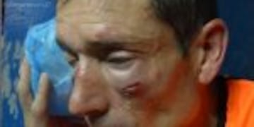 Asu00ed quedu00f3 el rostro de Claudio Elichiri, el u00e1rbitro agredido en Sarmiento de Ayacucho - Sansinena en el Federal B.