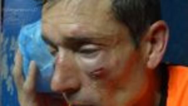 Asu00ed quedu00f3 el rostro de Claudio Elichiri, el u00e1rbitro agredido en Sarmiento de Ayacucho - Sansinena en el Federal B.
