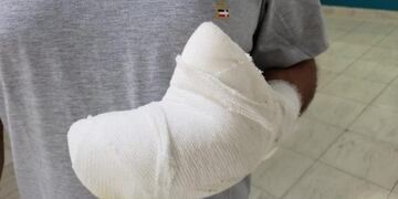 Un empleado de Defensa Civil de la Municipalidad de Córdoba resultó herido por la pirotecnia\u002E (El Doce TV)