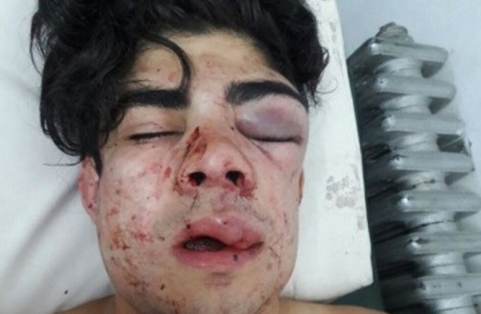 Continúa internado el chico atacado por una patota por su tonada chilena