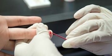 AHF Argentina realizará testeos gratuitos de VIH en Córdoba