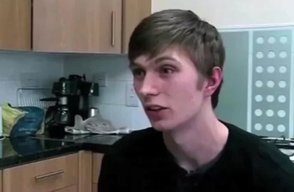 No se lavó los dientes por 20 años y mostró cómo le quedaron