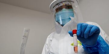 A healthcare worker, wearing a protective suit and a face mask, holds a test tube after administering a nasal swab in the medical center in Positano, as Italy eases some of the lockdown measures put in place during the coronavirus disease (COVID-19) outbreak, in Positano, Italy, May 22, 2020\u002E REUTERS/Ciro De Luca