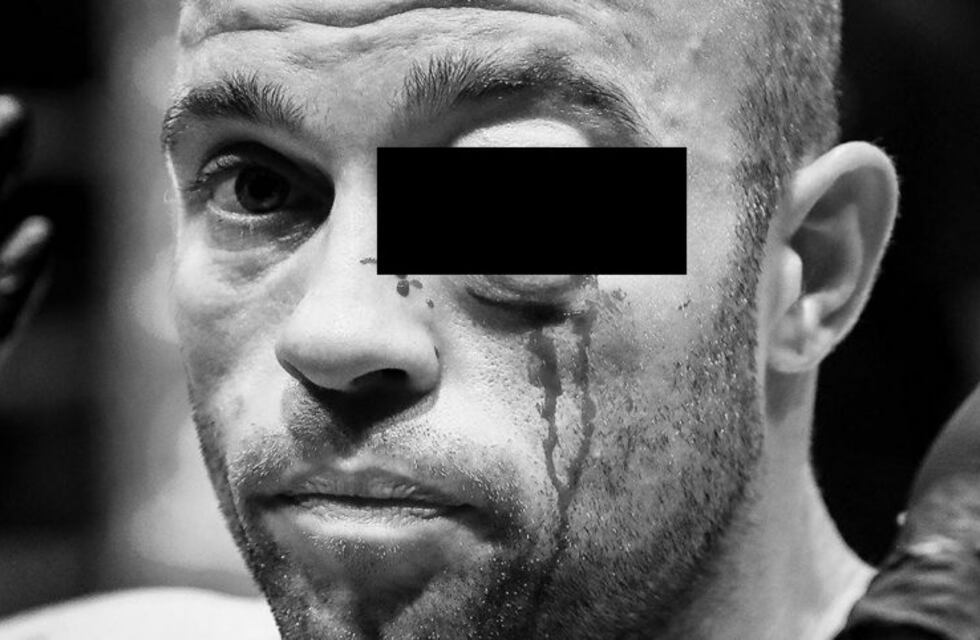 Así quedó el rostro de un luchador de MMA tras recibir un violento rodillazo