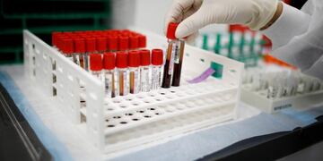 FILE PHOTO: A health worker takes test tubes with plasma and blood samples after a separation process in a centrifuge during a coronavirus disease (COVID-19) vaccination study at the Research Centers of America, in Hollywood, Florida, U\u002ES\u002E, September 24, 2020\u002E REUTERS/Marco Bello/File Photo