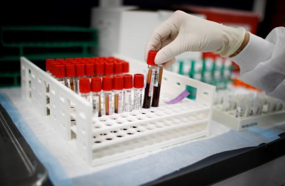 Chubut: 259 nuevos contagios de coronavirus y dos fallecidos