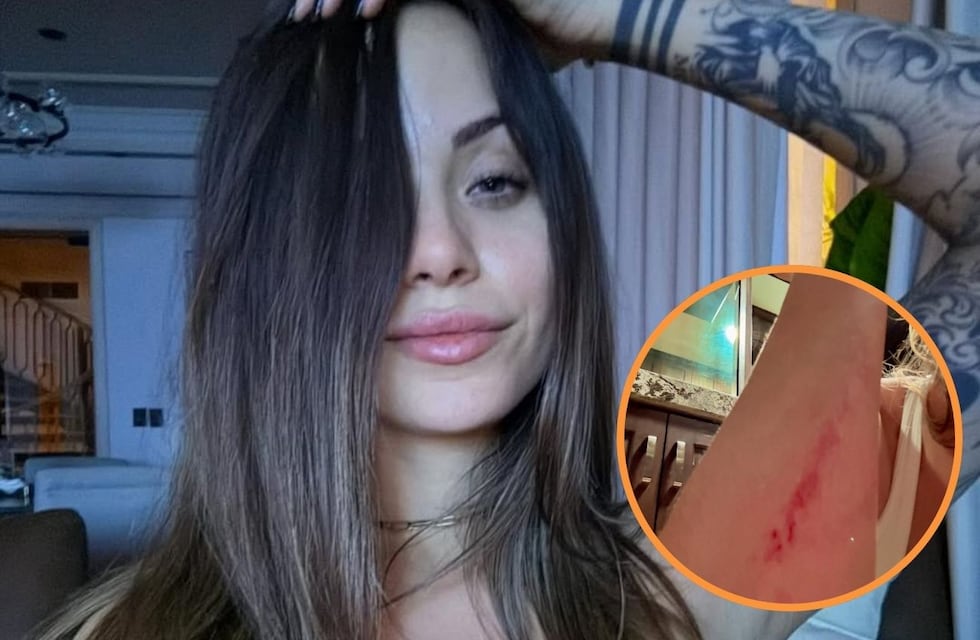 Con imágenes muy fuertes, la influencer mexicana Melanie Pavola denunció a su pareja: “Golpeador”