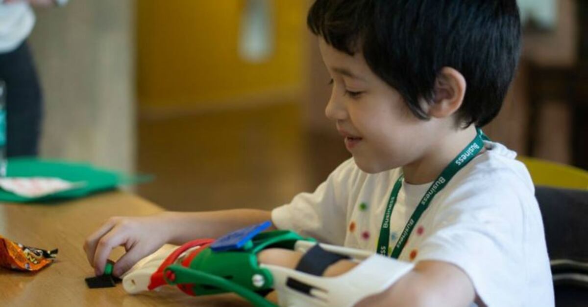 Entregarán prótesis de manos y brazos en Córdoba\u002E