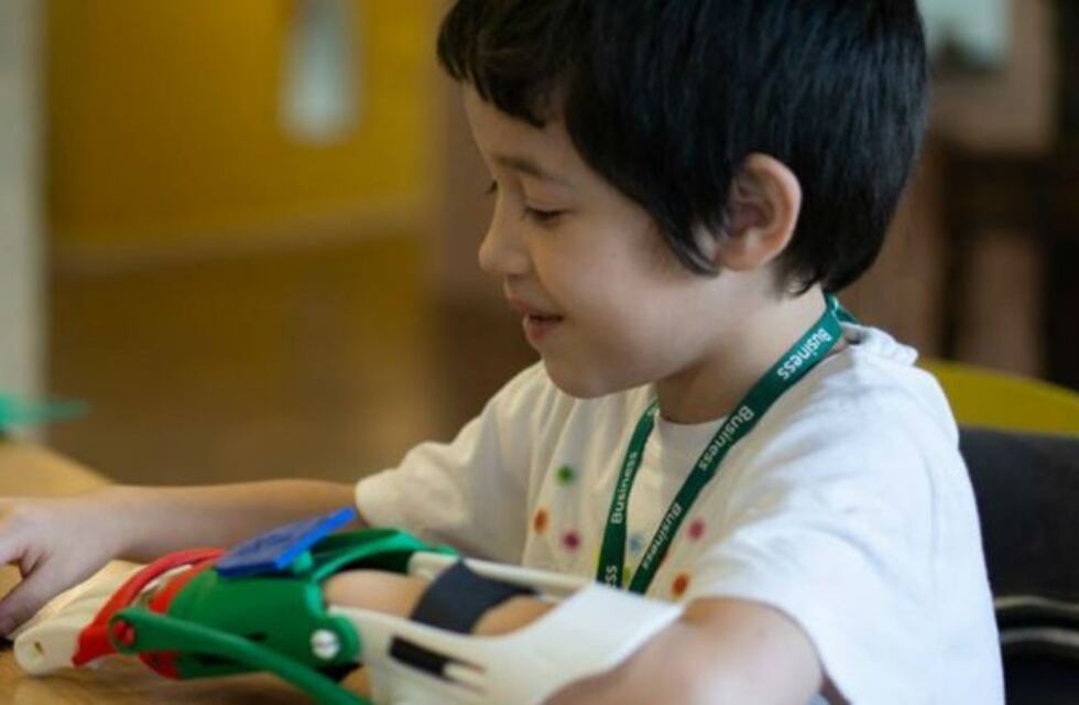 Regalarán prótesis de manos y brazos a tres familias de Córdoba