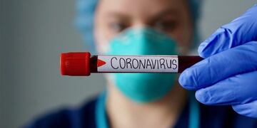 Chaco: 27 personas están con arresto domiciliario por romper el aislamiento obligatorio\u002E