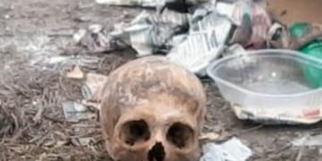 Encontraron un cru00e1neo en un contenedor.