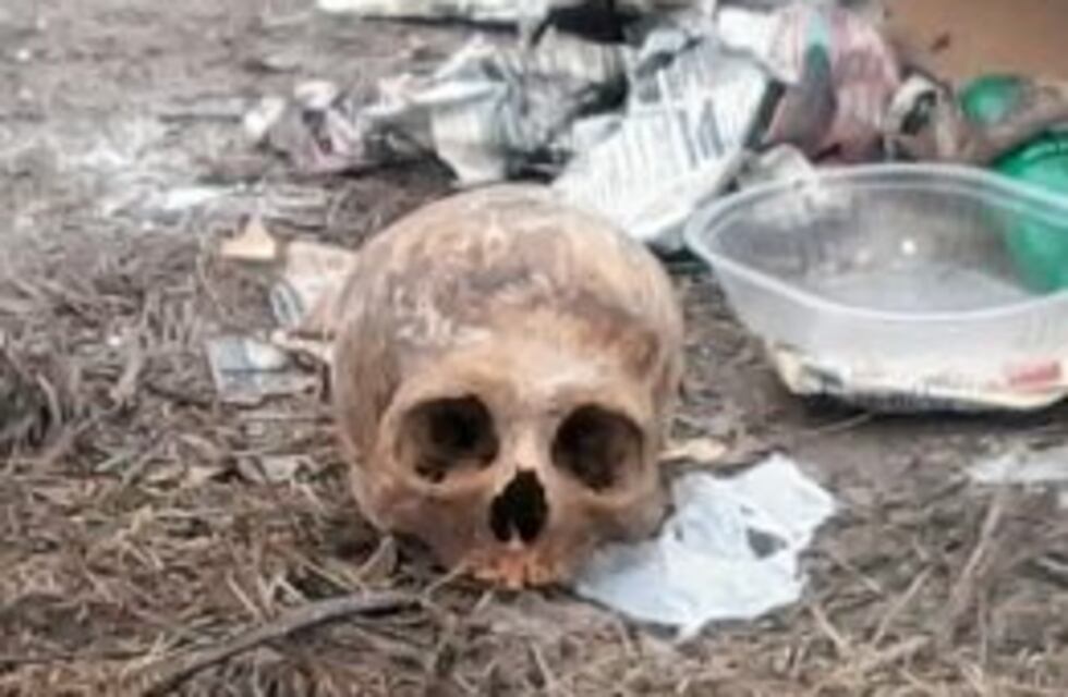 Un vecino encontró un cráneo en un contenedor de basura del centro y comenzó un importante operativo para determinar su procedencia