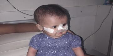 La pequeña Tutce, de San Francisco, necesita de la ayuda de todos\u002E (Foto Radiocanal)