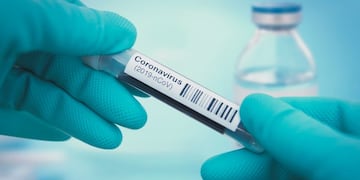 23/04/2020 Imagen de recurso del coronavirus\u002E POLITICA SALUD NARVIKK