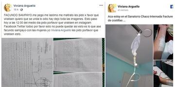 Siguen buscando a Facundo Sampayo por golpear salvajemente a su pareja\u002E (Web)\u002E