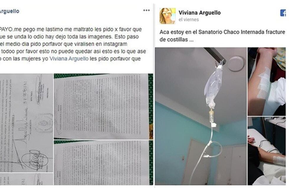 Siguen buscando a Facundo Sampayo por golpear salvajemente a su pareja
