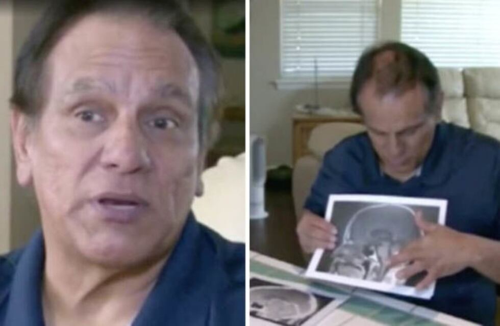 Tenía un tumor cerebral y desapareció justo antes de la cirugía