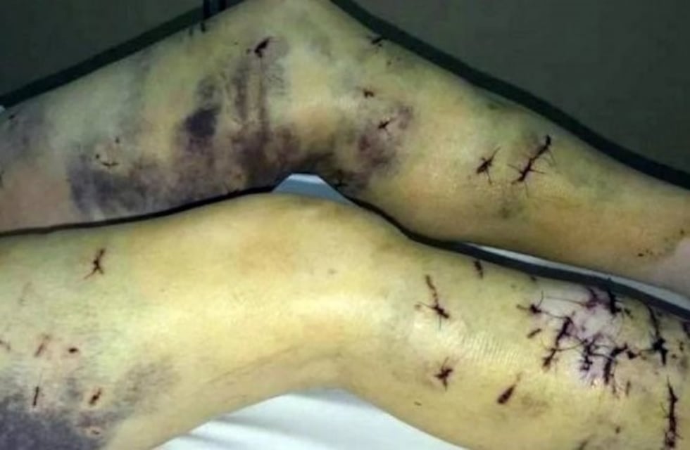 Ushuaia: Una jauría de perros salvajes atacó a una mujer y mantiene en vilo a los ciudadanos