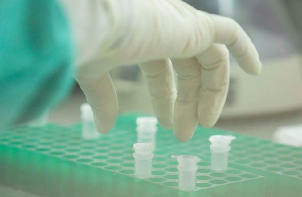 Coronavirus en Salta: 102 nuevos casos y 2 fallecidos en las últimas 24 horas