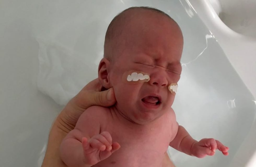 Un bebé prematuro recibió la primera cirugía cardiovascular en el Hospital Materno Neonatal