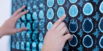 Jornada sobre el ACV en Santa Rosa (tn\u002Ecom)