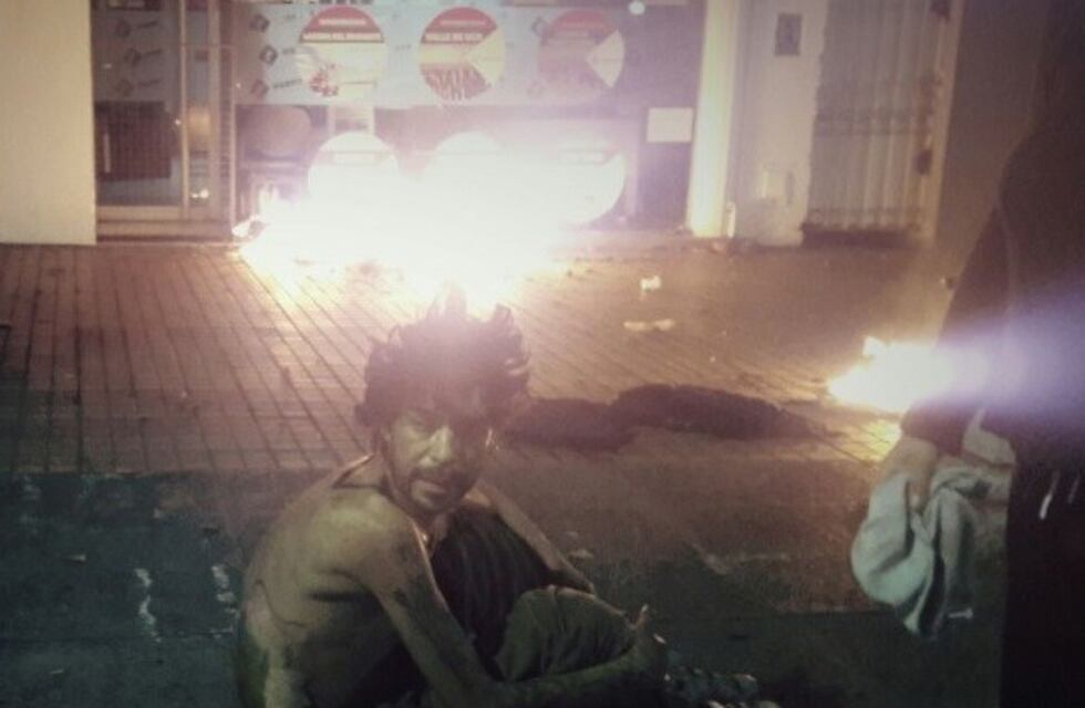 Está preso por abuso sexual el indigente al que habían prendido fuego