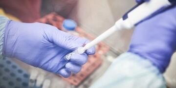 Mendoza contacta a empresa China para comprar reactivos para diagnosticar casos de coronavirus\u002E