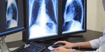 Diagnóstico por imágenes (Foto: Sanatorio Allende)\u002E
