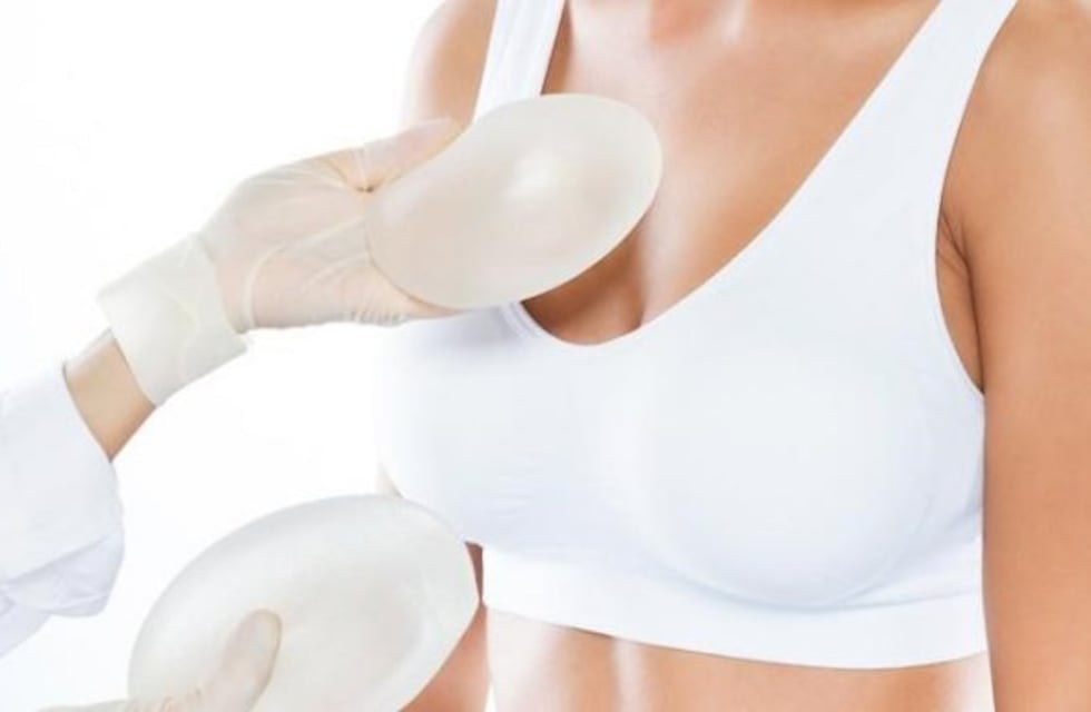 Implantes mamarios: todo lo que hay que saber