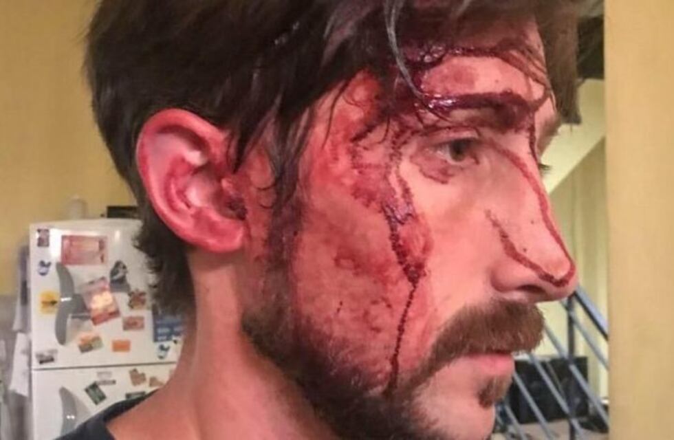 San Martín: asaltan, golpean y amenazan a un concejal kirchnerista