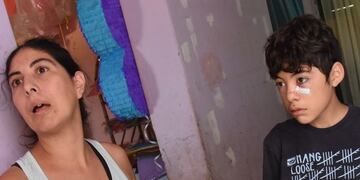 Atacado por un perro\u002E