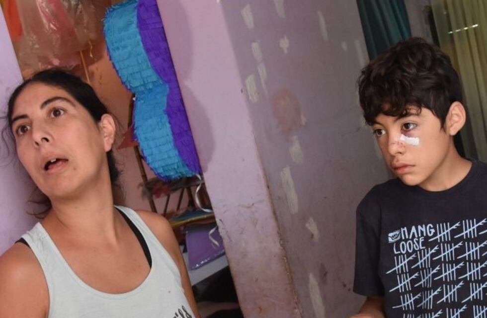 Fue a dormir a la casa de su amigo y un perro lo atacó brutalmente