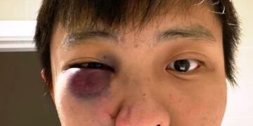 Jonathan Mok, víctima de una golpiza\u002E (web)