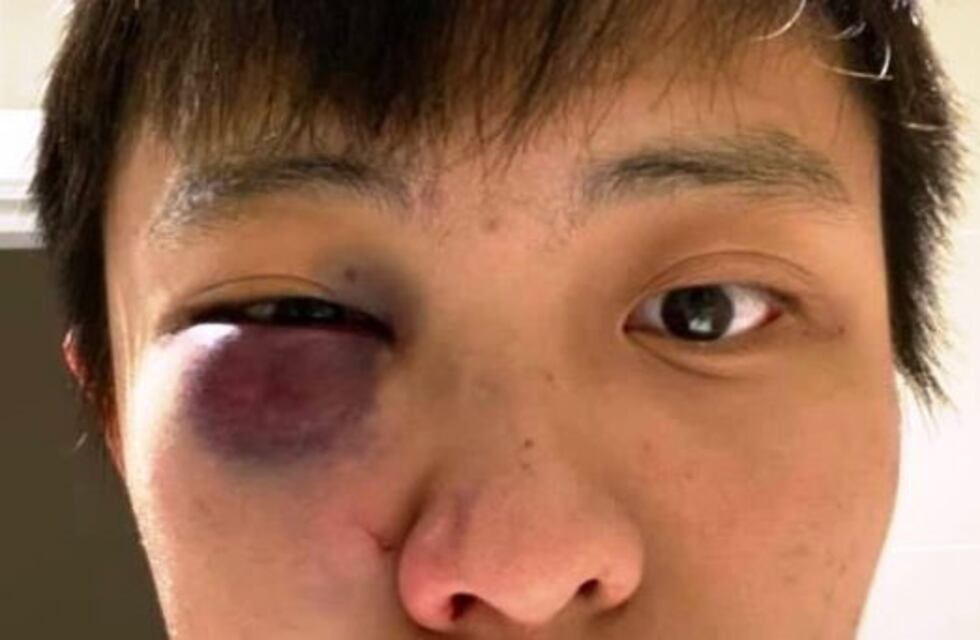 Un asiático recibió una golpiza al grito de "no quiero tu coronavirus en mi país"