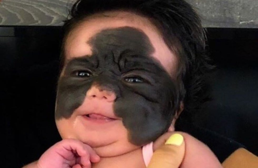 La bebé a la que llamaron "monstruo" le hace frente a las críticas con las fotos más tiernas