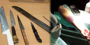 Apuñalaron a un policía que les exigió que respeten el aislamiento\u002E (Web)\u002E