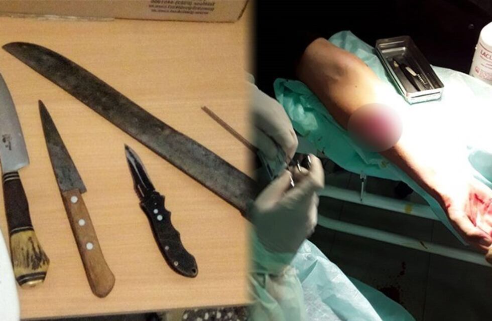 Apuñalaron a un policía que les exigió que respeten el aislamiento