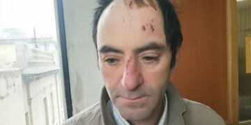 En Río Cuarto presentaron denuncia por tortura policial (Gentileza: Puntal)