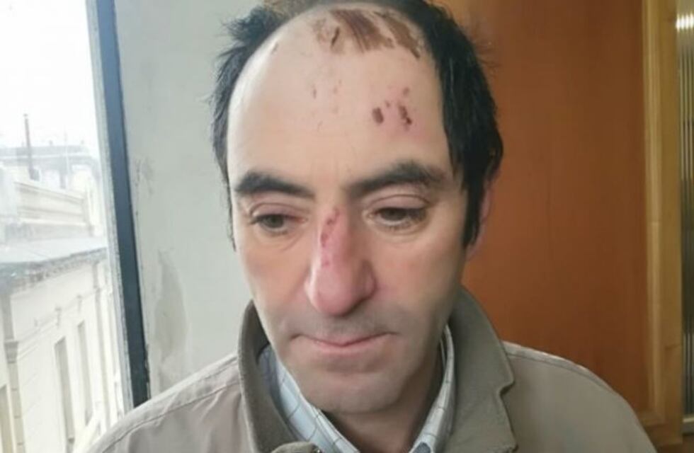Un hombre que estuvo detenido en Río Cuarto denuncia tortura policial