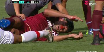 Fuerte choque de cabeza entre Candia y Braghieri, que termina con el jugador de Lanús inconsciente. / Gentileza.